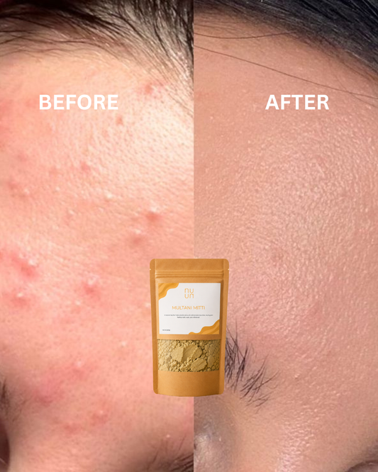 MULTANI MITTI